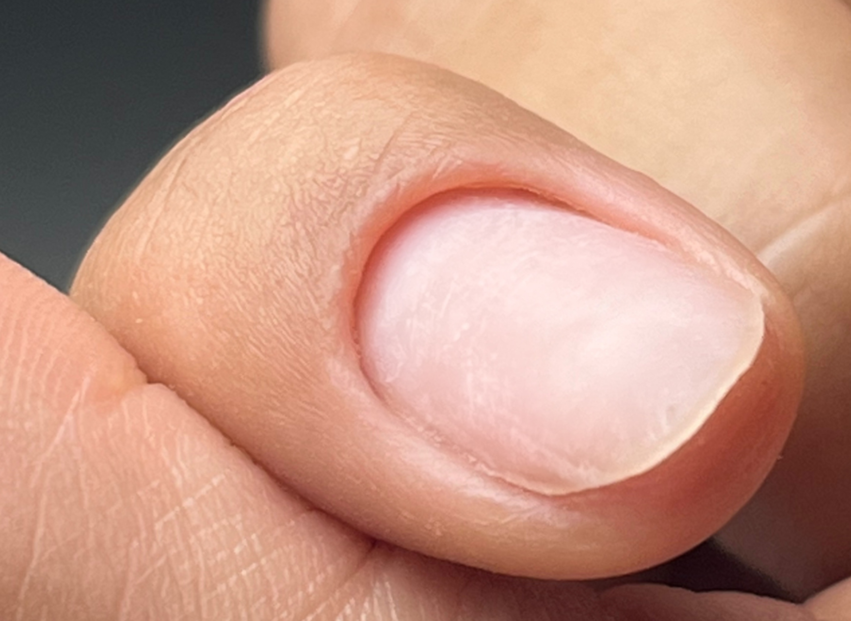 ongle tout savoir